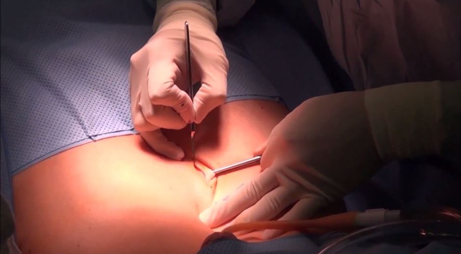 Best of Video of pelvic exam